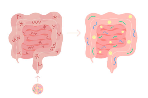便移植の効果と治療法について徹底解説
